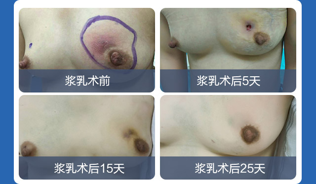 ��ǧ�������������ǻ�����Ч�õĳ�ŵ